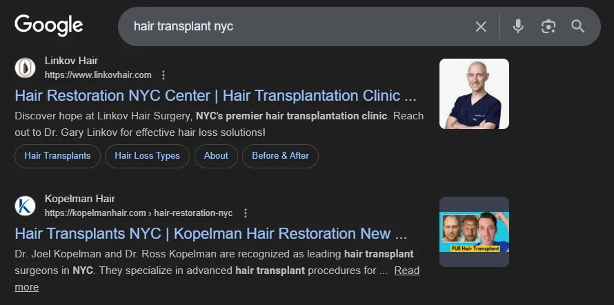 hair-transplant-nyc
